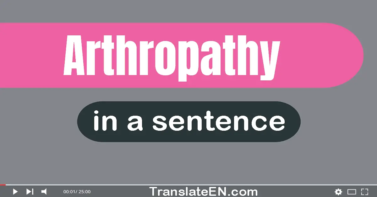 Use "arthropathy" in a sentence | "arthropathy" sentence examples
