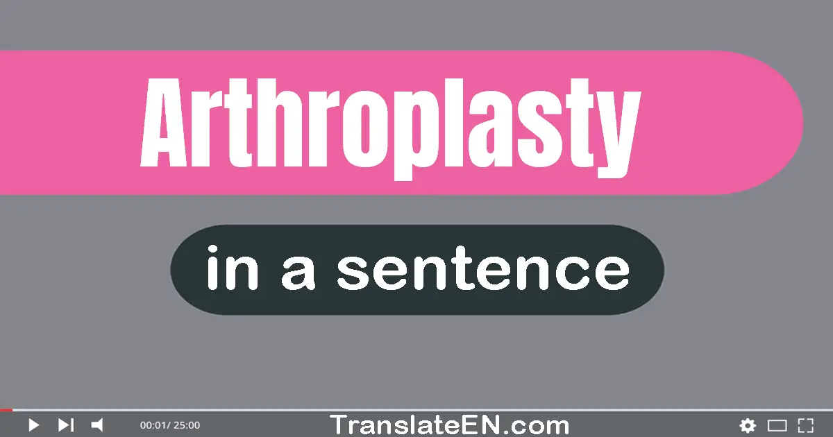 Use "arthroplasty" in a sentence | "arthroplasty" sentence examples