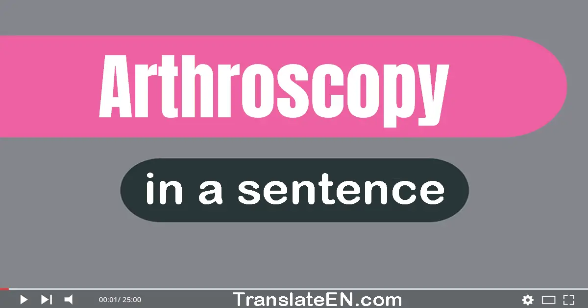 Use "arthroscopy" in a sentence | "arthroscopy" sentence examples