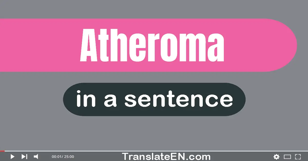 Use "atheroma" in a sentence | "atheroma" sentence examples
