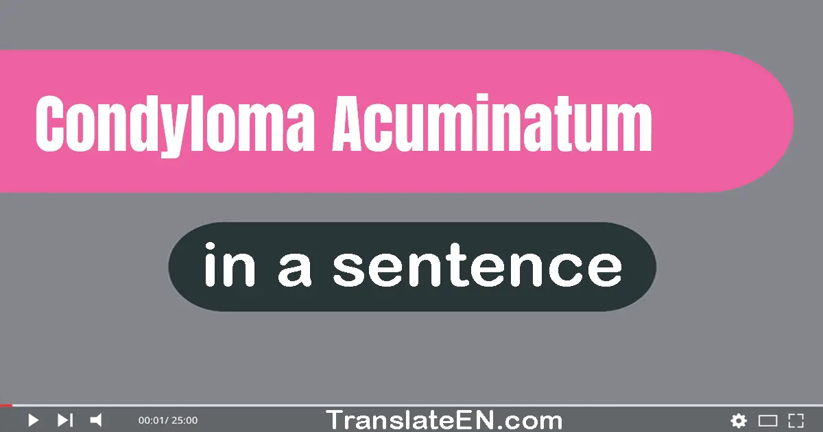 Use "condyloma acuminatum" in a sentence | "condyloma acuminatum" sentence examples