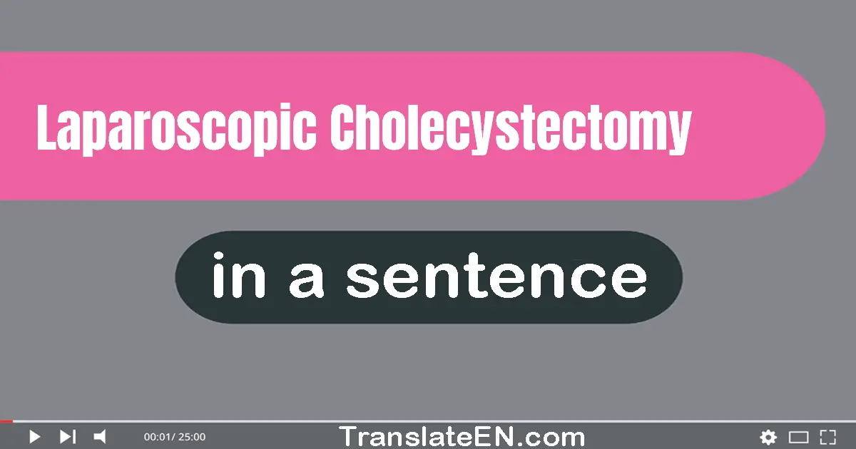 Use "laparoscopic cholecystectomy" in a sentence | "laparoscopic cholecystectomy" sentence examples