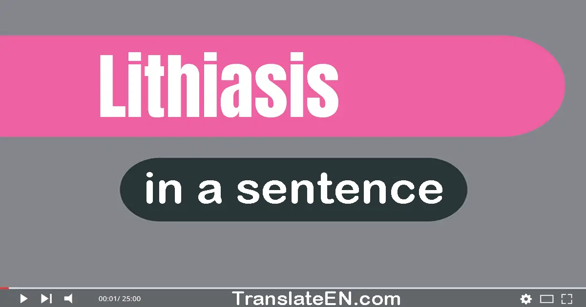 Use "lithiasis" in a sentence | "lithiasis" sentence examples