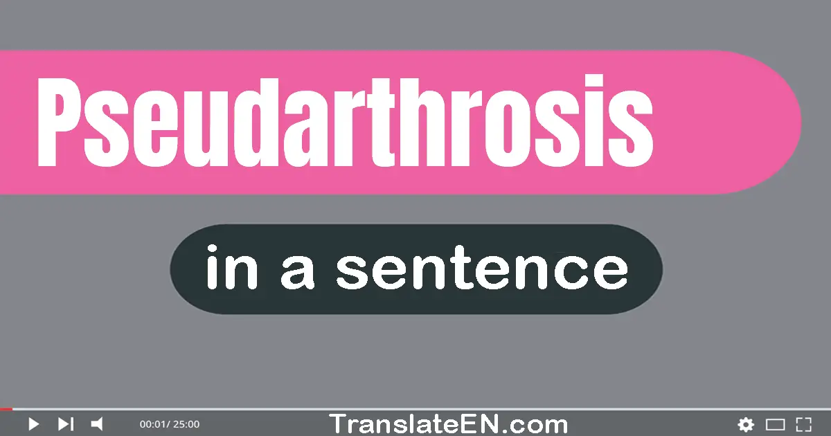 Use "pseudarthrosis" in a sentence | "pseudarthrosis" sentence examples