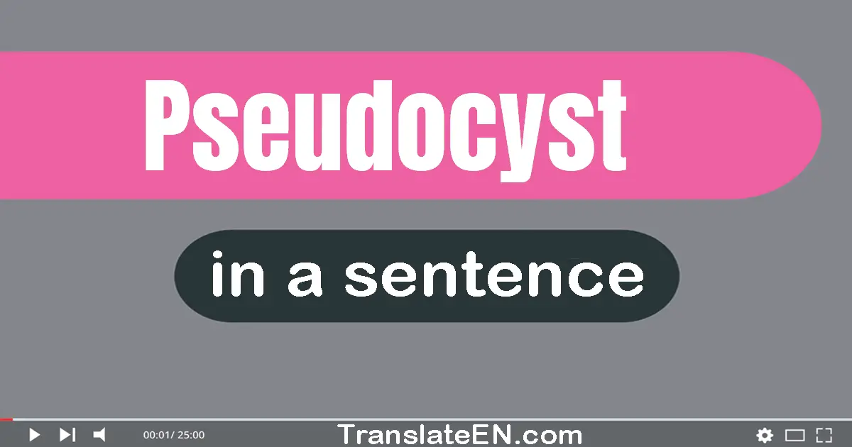 Use "pseudocyst" in a sentence | "pseudocyst" sentence examples