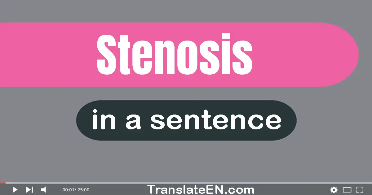 Use "stenosis" in a sentence | "stenosis" sentence examples