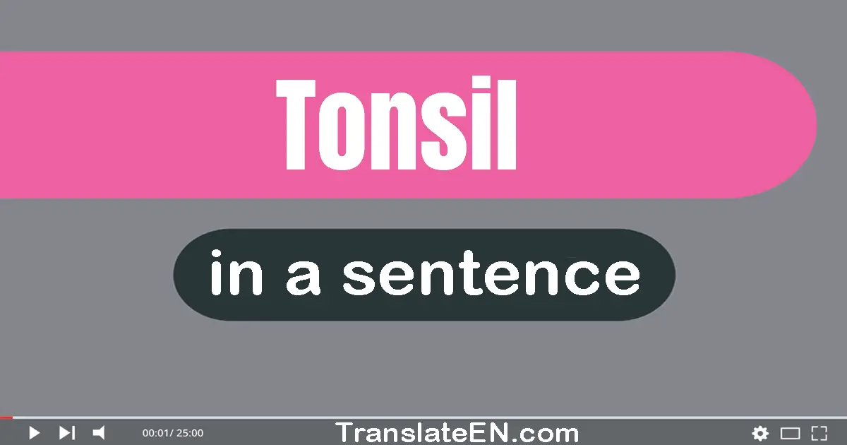 Use "tonsil" in a sentence | "tonsil" sentence examples