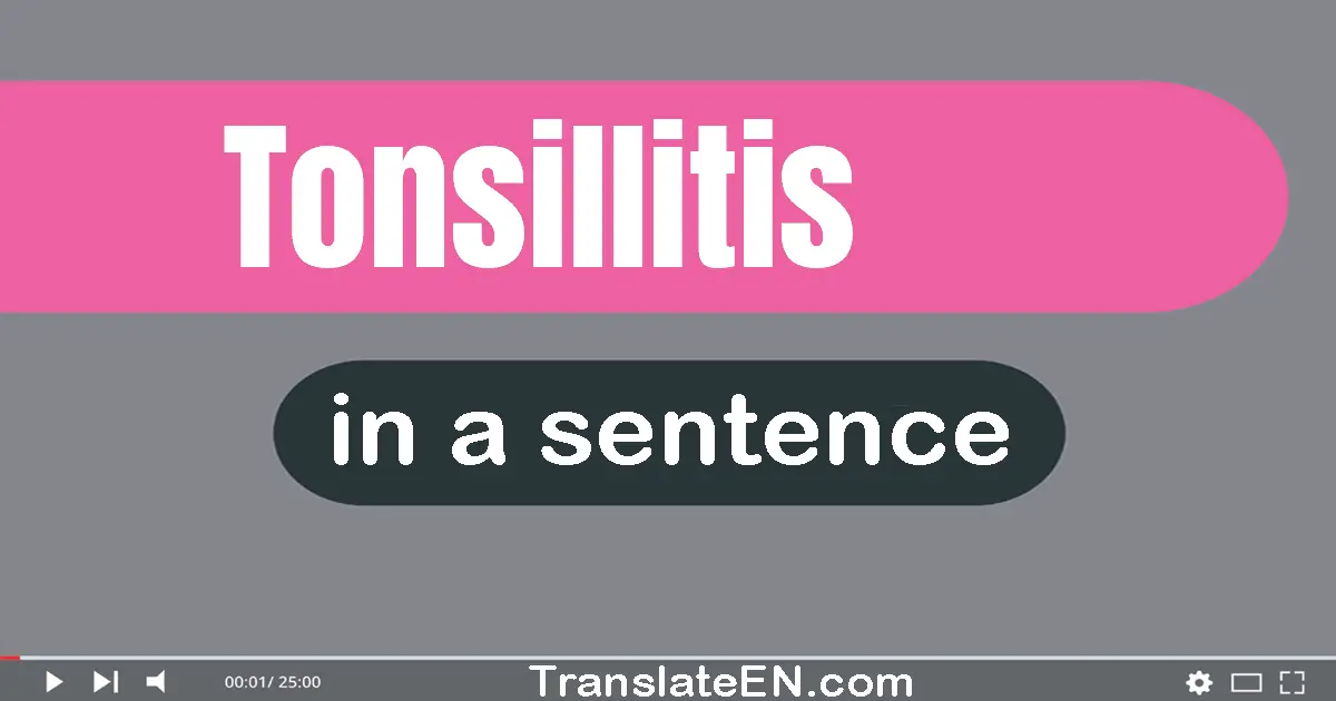 Use "tonsillitis" in a sentence | "tonsillitis" sentence examples