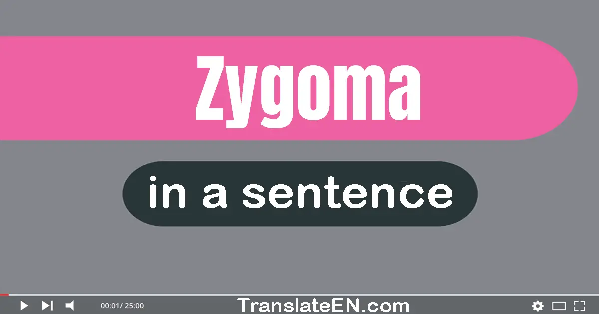 Use "zygoma" in a sentence | "zygoma" sentence examples